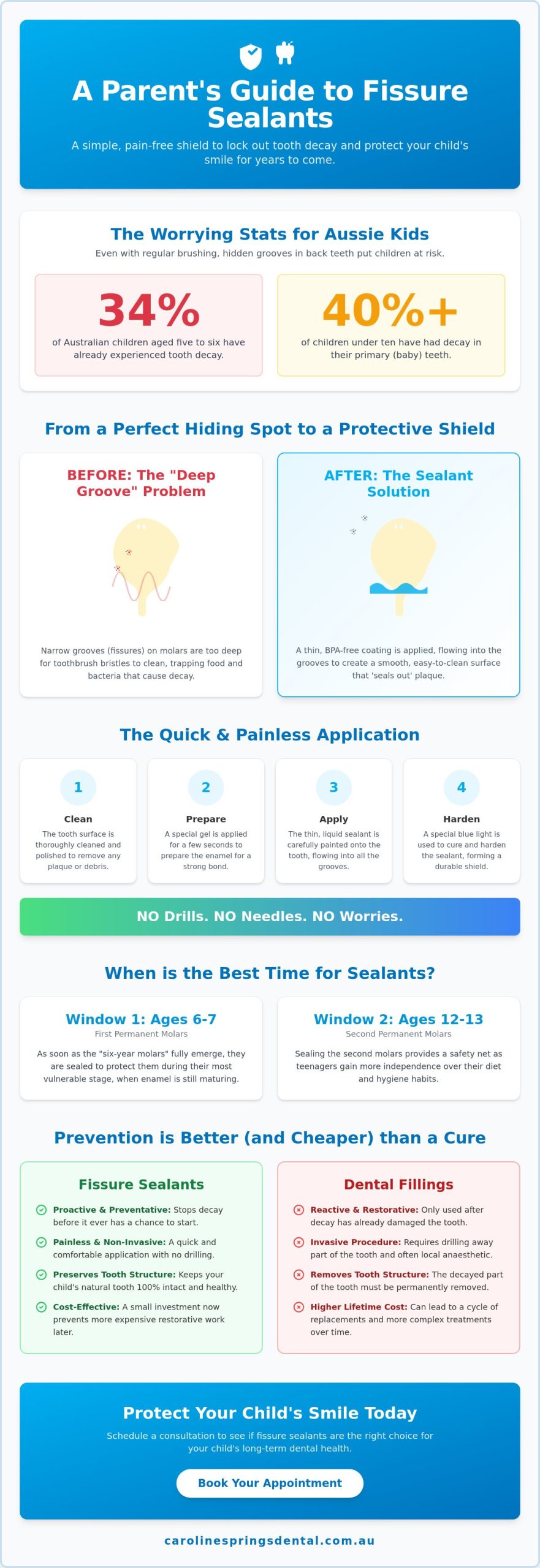 Fissure Sealants for Kids: The Complete 2026 Parent’s Guide to Cavity Prevention