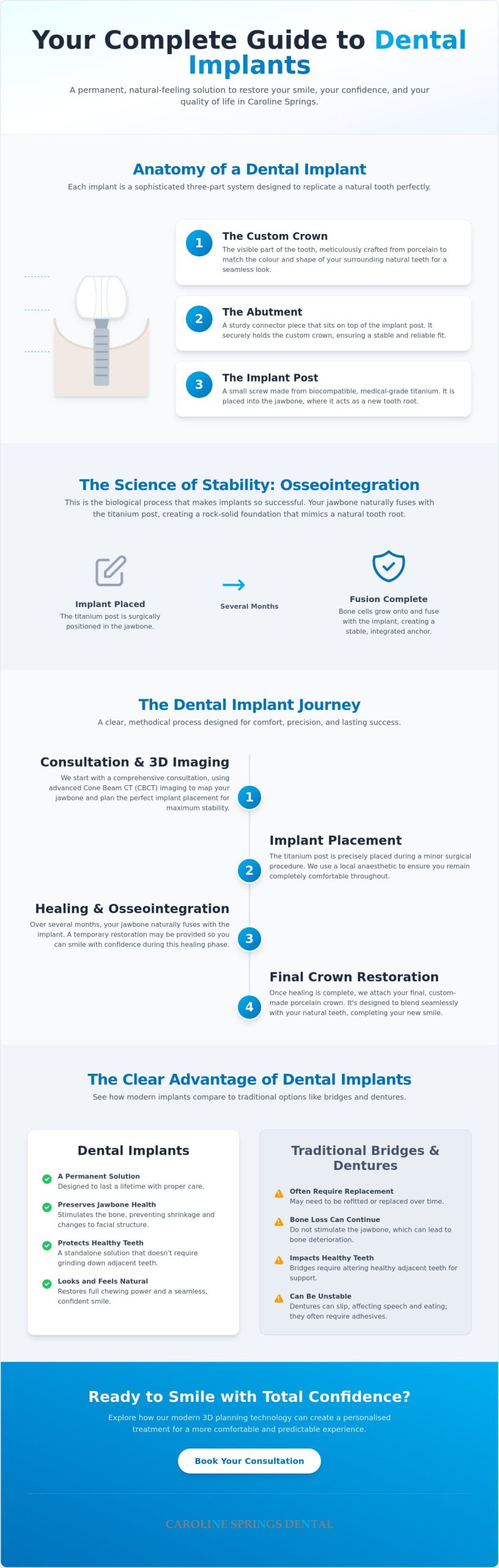 Dental Implants in Caroline Springs: A Complete Guide to Restoring Your Smile